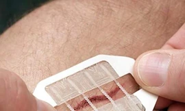 Miếng dán tiện lợi giúp khép vết thương hở mau hơn