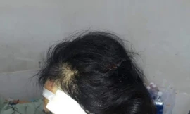 Bắt tạm giam chồng cũ đánh vợ gây thương tích