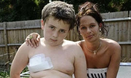 Thoát chết thần kỳ khi bị cọc sắt đâm gần tim