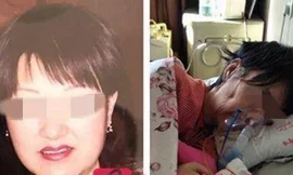 “Hot“: Nữ doanh nhân hút mỡ thất bại trở thành người thực vật, mất sau 10 năm liệt giường