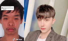 Khoe quá trình “lột xác”, chàng trai gây sốc khi lấy ảnh tội phạm làm ảnh chưa phẫu thuật