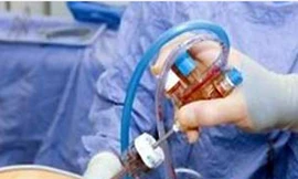 Bọt biển nằm trong bụng suốt 15 năm