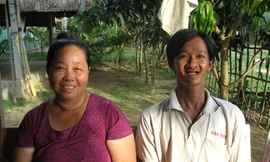 Người đàn ông lột da như rắn và chưa từng mọc răng