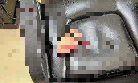 Nam thanh niên bị chém đứt lìa bàn tay ở tiệm cắt tóc