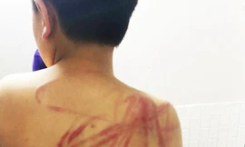 Khởi tố người cha đánh đập, hành hạ con trai 10 tuổi 