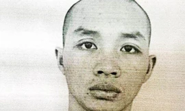 Phạm nhân bỏ trốn khi được đưa đến bệnh viện để phẫu thuật 