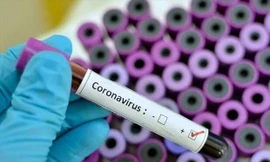 Công an xác minh 33 gói thầu mua sinh phẩm, kit xét nghiệm tại Vĩnh Phúc