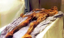 Nguyên nhân mới về cái chết của người băng Otzi