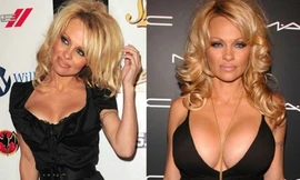 10 sao nữ chi nhiều tiền nhất để nâng ngực