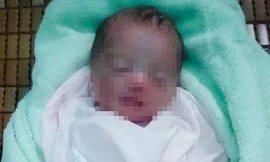 Bé gái đáng thương bị bỏ rơi trong bụi chuối (Ảnh: Pháp luật TP HCM)