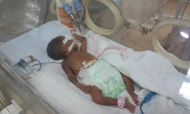 Bé gái được cấp cứu nhiều ngày trong lồng kính. Ảnh: Lê Hoàng/VnExpress