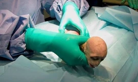 Chú khỉ con có khuôn mặt giống Voldemort. Ảnh: SWINS.