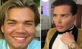Rodrigo trước và sau khi phẫu thuật. Ảnh: DM & Rodrigo Alves.