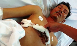 Vết thương của bệnh nhân Trần Trường Giang lành và sức khỏe hồi phục nhanh.