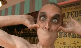 Người có da kéo giãn như kẹo cao su