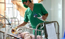 Bé ba tuổi bị bố tẩm xăng đốt đang nguy kịch