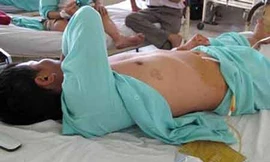 Bác đơn kiện vụ thách cắn 'của quý' đại gia