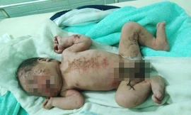 Bé trai sơ sinh bị bỏ rơi còn nguyên dây rốn. Ảnh: H.Thơ