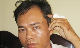 Không dung túng, bao che công an đánh lái xe