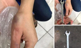 Hà Nội: Cờ lê sắt từ tầng cao chung cư rơi trúng người phụ nữ đang bế con