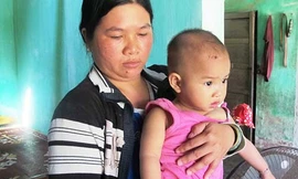 Bé gái bị liệt tay do hộ sinh đỡ ngược khi đẻ?