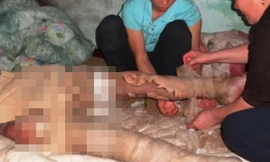 Tẩm 5 lít xăng lên người tự thiêu vì... giận vợ