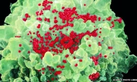 Ca nghi nhiễm HIV hiếm có giữa đôi đồng tính nữ