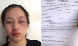 Chị Nông Thị Mai tố bị CSGT gây thương tích.