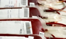 Thiếu máu và cách phòng ngừa