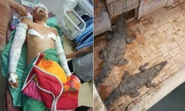 Đi vệ sinh gần ao, người đàn ông bị cá sấu cắn suýt chết