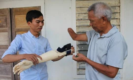 Ngô Văn Dết thử nghiệm “bàn tay robot”với ông Lê Quang Trọng. Ảnh: N.N 