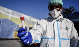 Một nhân viên y tế cầm dụng cụ xét nghiệm Covid-19 tại bệnh viện ở Brescia, miền bắc Ý, hôm 10/3. ảnh: AP 