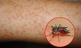 Ảnh minh hoạ: Internet