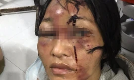 Gã ‘chồng hờ’ đánh đập vợ con tàn bạo