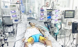 Nguy cơ trẻ bị viêm cơ tim 