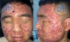 Nạn nhân của mỹ phẩm giả mua trên mạng