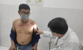 Nam bệnh nhân ngụ tại huyện Bình Chánh bị tổn thương da do tiếp xúc với kiến ba khoang