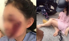 Hiểm họa rình rập từ những trang phục chống nắng của hội chị em khi tham gia giao thông