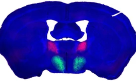 Tìm được tế bào thần kinh ham muốn tình dục ở người? 