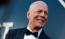 Sa sút trí tuệ vùng trán nguy hiểm như thế nào? 