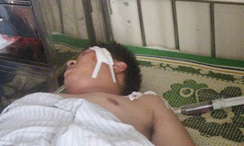 Báo động tình trạng côn đồ hành hung cảnh sát