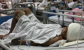 Dù đã qua cơn nguy kịch nhưng bé trai 12 tuổi bị chó cắn này vẫn rất hoảng loạn.