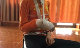 Cháu V.N.Q. bị rạn xương tay phải khi Nguyễn Trọng Trình thực hiện hành vi xâm hại tình dục