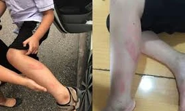 Phẫn nộ cô giáo quát nạt, liên tiếp đánh học sinh vì làm bài chậm