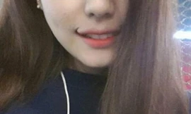 Kì quặc mốt tạo 'môi cười' của gái Hàn