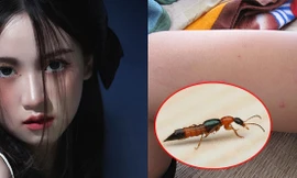 Sắc màu SV 30/6: Bản sao Jisoo bất ngờ nổi tiếng, kiến ba khoang tấn công ký túc xá 