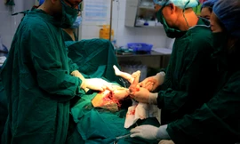 Nín thở xem bác sĩ mổ đẻ ngôi ngược