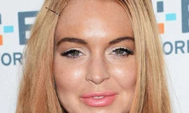 Mặt sưng vù, Lilo lại bị nghi 'đụng dao kéo'