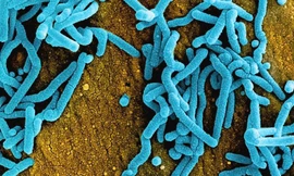 Virus Marburg gây tử vong cao nhưng không dễ lây 