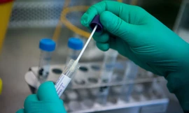 Ca mắc tăng, biến thể Omicron chiếm đa số 